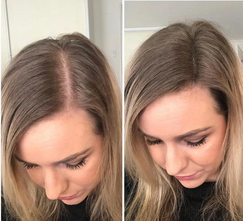 Anti Hair Loss Spray 99% Keratin Hair Fiber